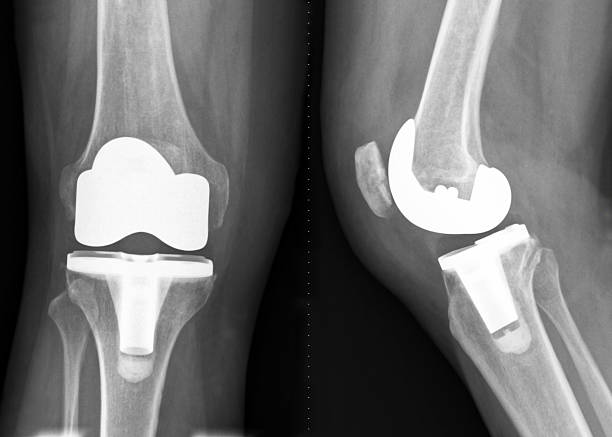 best knee replacement surgeon in chembur